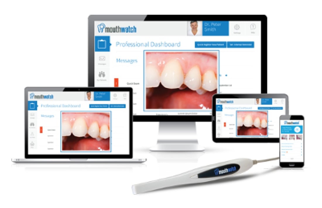 MouthWatch intraoral camera views
