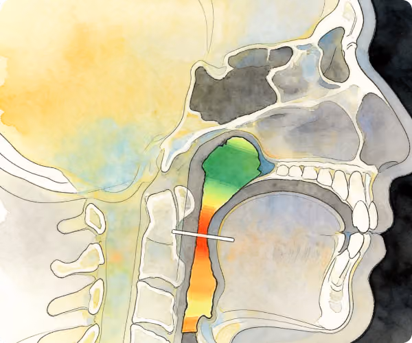 Airway dentistry illustration and dental structure diagram