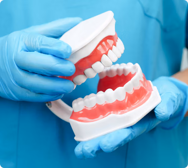 Gloved hands hold a dental model during a fluoride-free sealants consultation.