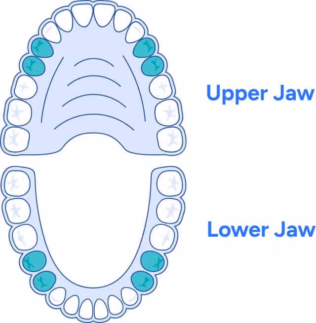 Premolars are highlighted just to make things super straightforward