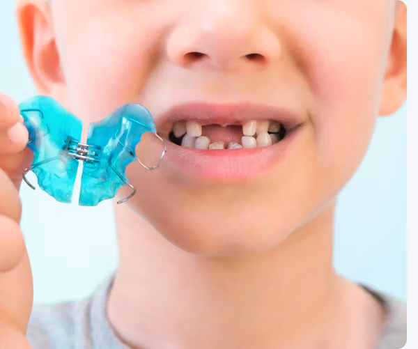 A child holding a blue dental retainer, showing missing front teeth and smiling slightly.