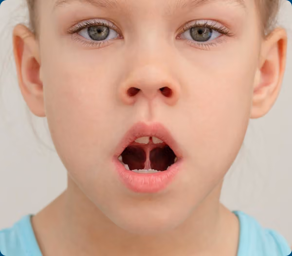 Close-up of a young child breathing through an open mouth, illustrating oral function and airway development.