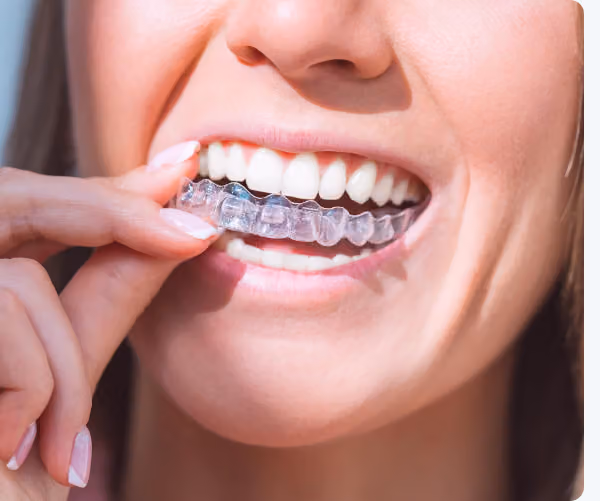 A clear dental retainer is placed inside an open blue and black plastic case against a blue background.