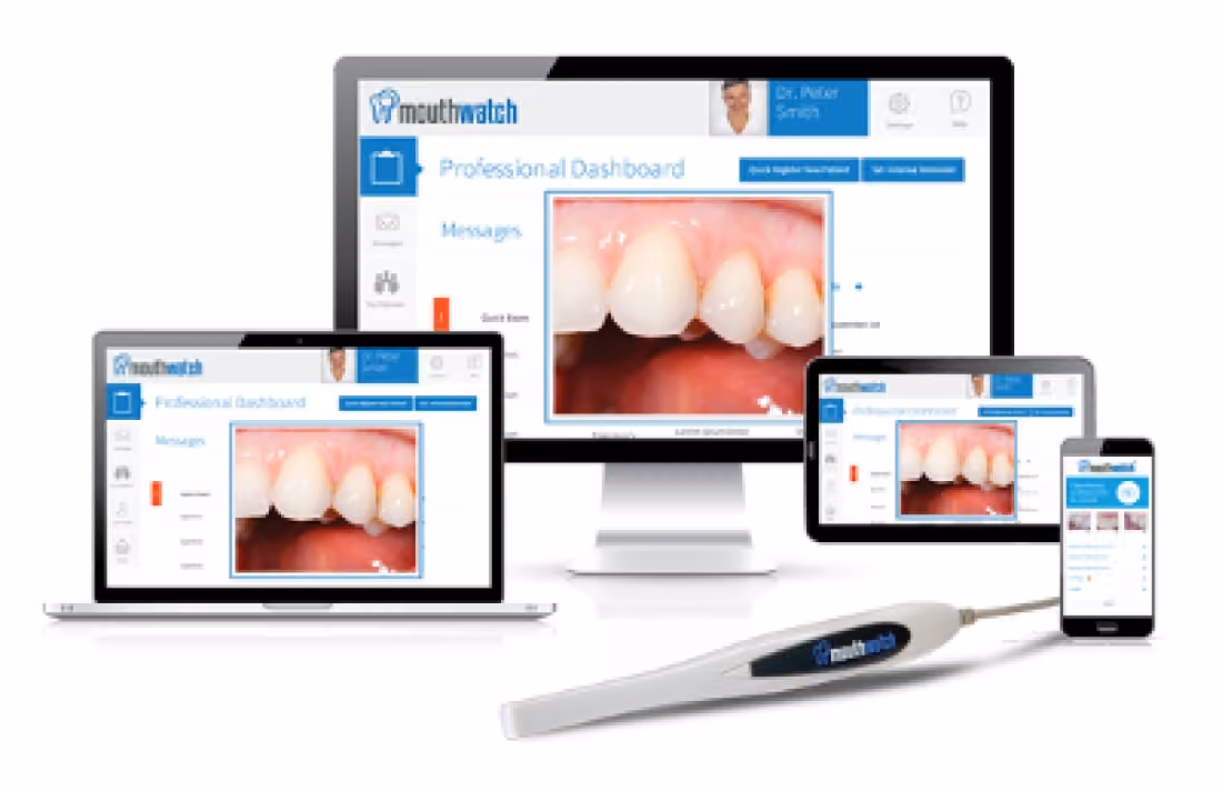 MouthWatch intraoral camera views