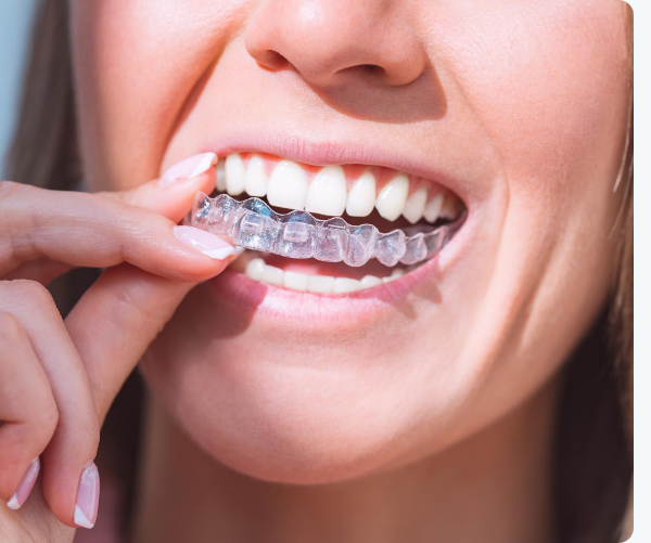 A clear dental retainer is placed inside an open blue and black plastic case against a blue background.
