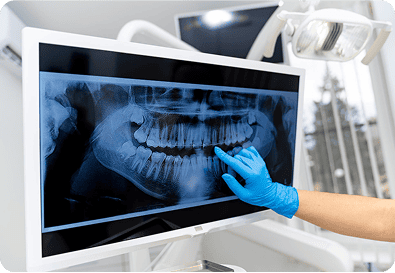 Emergency Dental Care in Friendswood