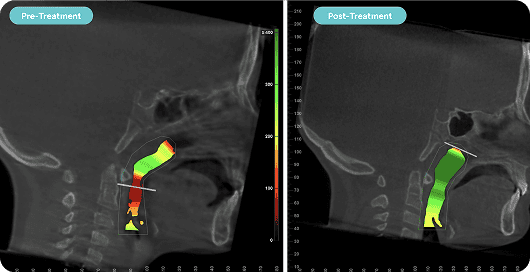 Airway Screening & Diagnostics in Houston, TX