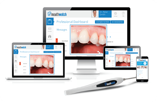 MouthWatch Intraoral Camera