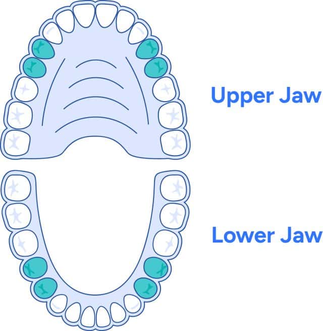 Premolars are highlighted just to make things super straightforward